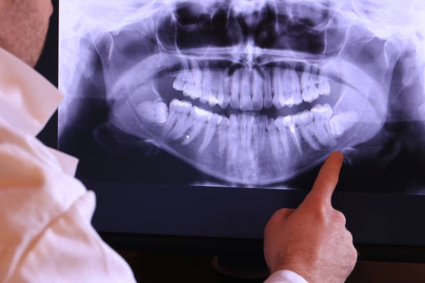 Best Emergency Dental Extractions in Gray, GA