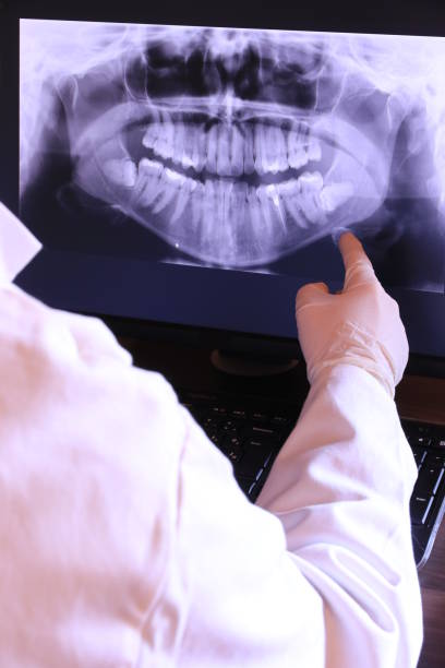 Best Emergency Dentist for Knocked-Out Tooth in Gray, GA
