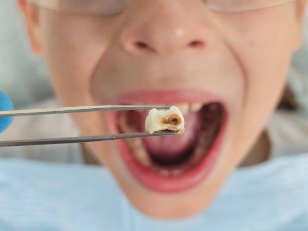 Best Emergency Dental Services for Seniors in Gray, GA